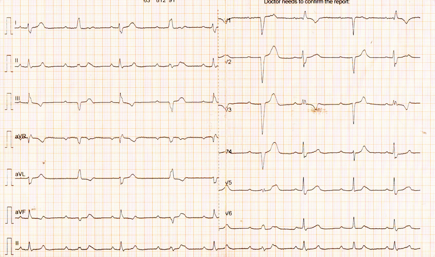 thamizh alternate bbb_001.jpg